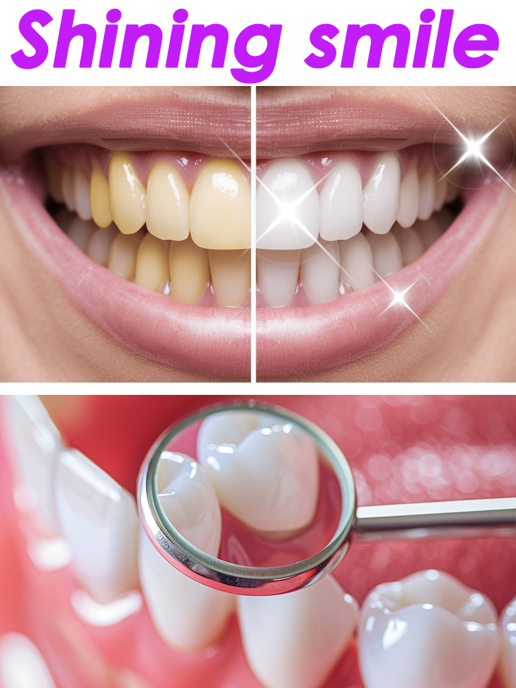 Teeth Whitening Xylitol - GlorySmile Sbiancamento dei denti Dentifricio fruttato