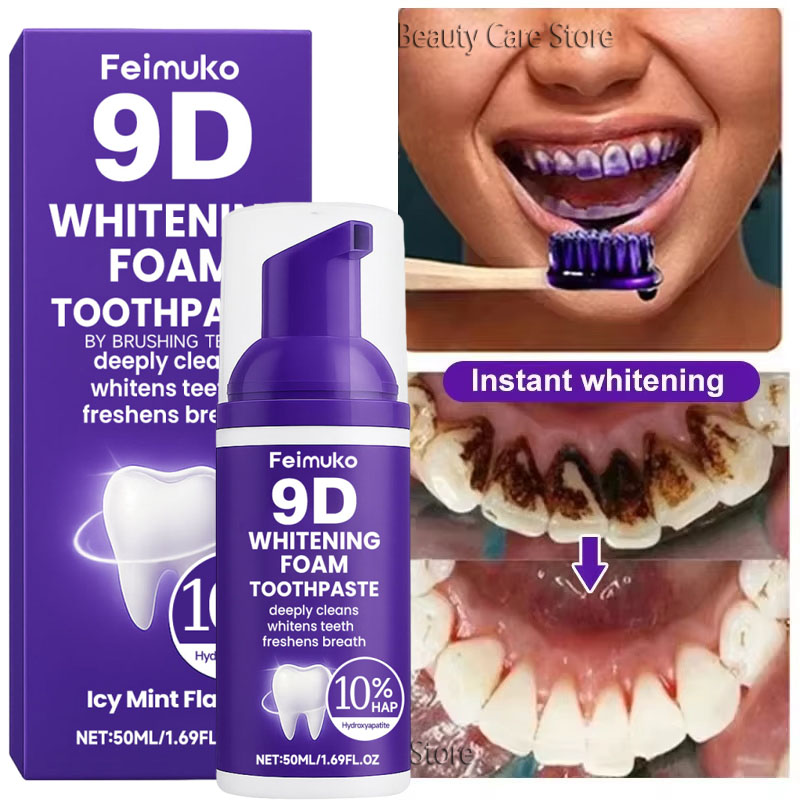 Teeth Whitening Yellow Teeth - Dentifricio sbiancante 9D viola in mousse,