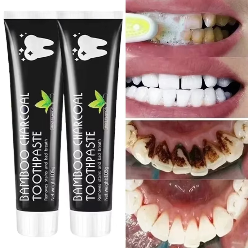 Teeth Whitening Yellow Teeth - Dentifricio sbiancante Dentifricio al carbone di