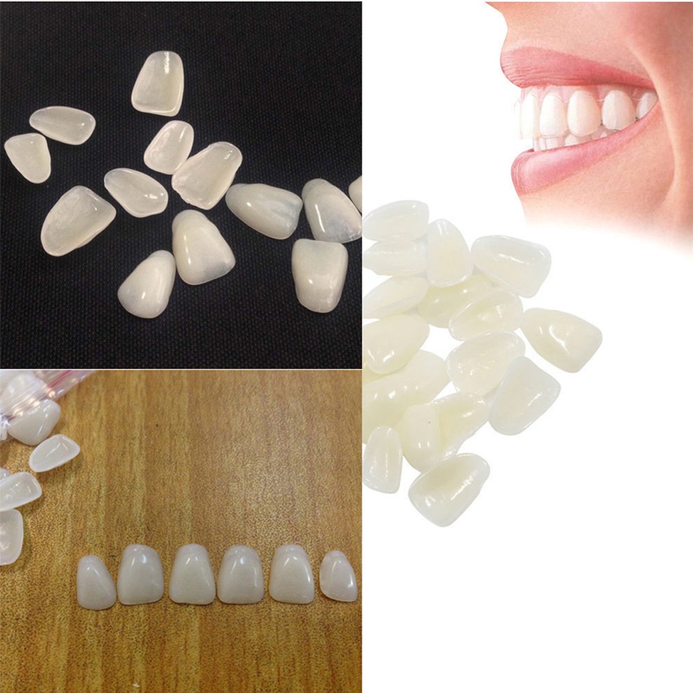 Teeth Whitening Veneers - 70 pz/pacchetto impiallacciature sbiancanti ultrasottili dentali