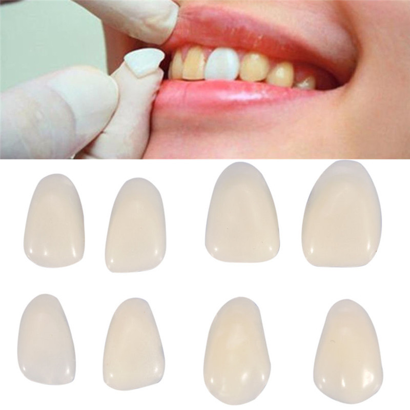 Teeth Whitening Veneers - Denti finti dentali Corona temporanea Denti