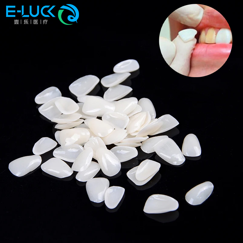 Teeth Whitening Veneers - 50 pezzi impiallacciature per denti dentali
