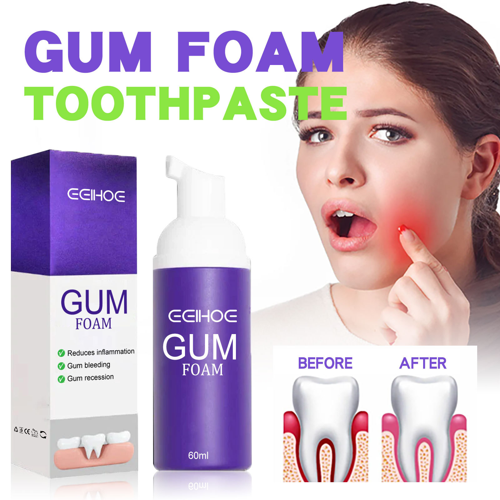 Teeth Whitening Yellow Teeth - 60ml Mousse Sbiancante Per Denti V34