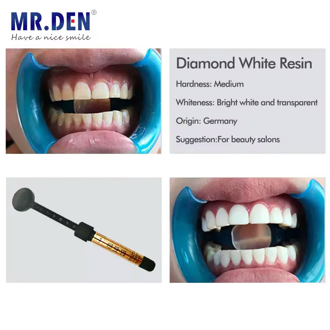Teeth Whitening Veneers - Materiale impiallacciato nano smalto sbiancamento dei