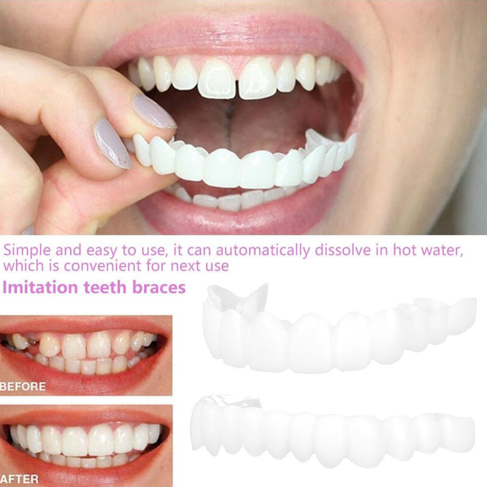 Teeth Whitening Veneers - 2 pz Uomo Donna Denti Temporanei