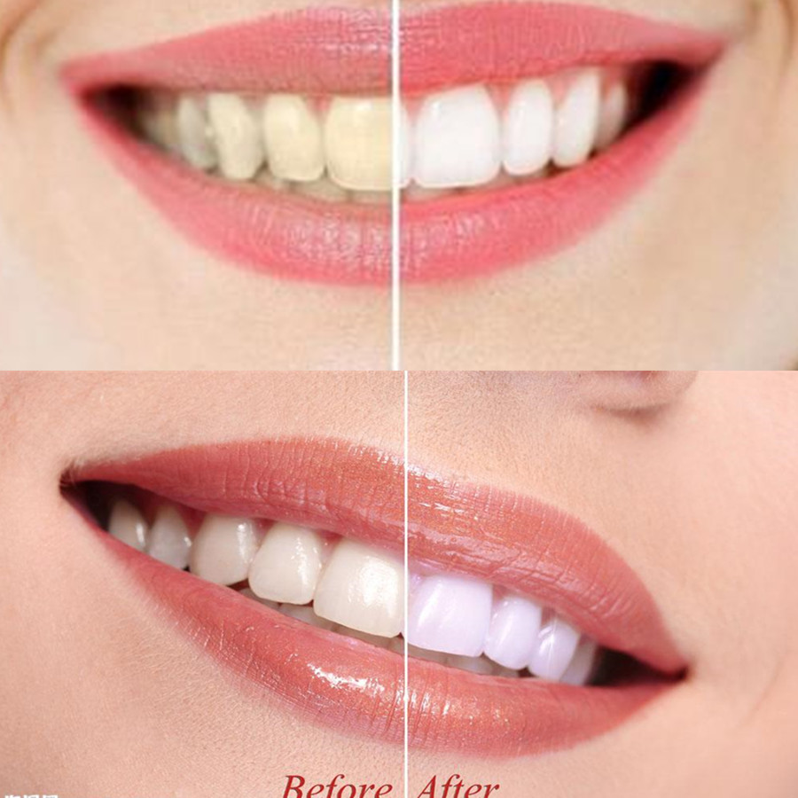 Denti di carbone di bambù dent - Teeth Whitening Yellow Teeth recensione e prezzo