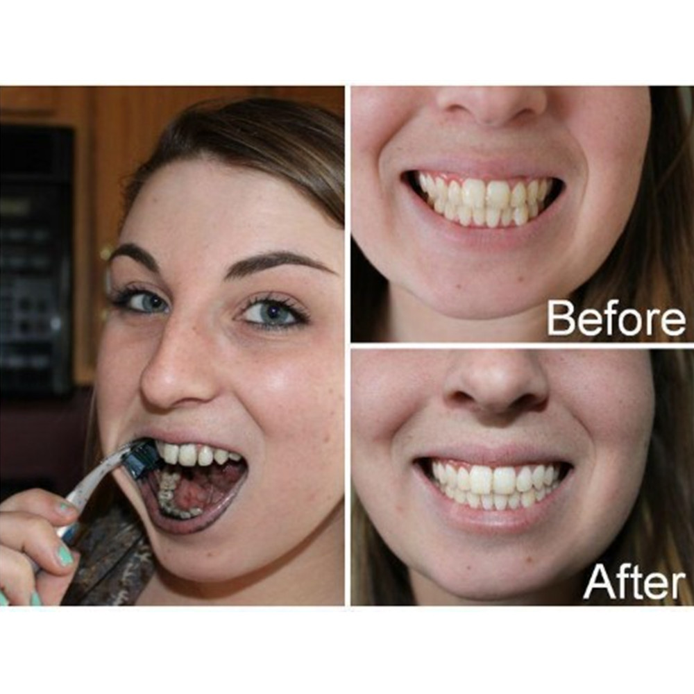 Denti di carbone di bambù dent - Teeth Whitening Yellow Teeth recensione e prezzo