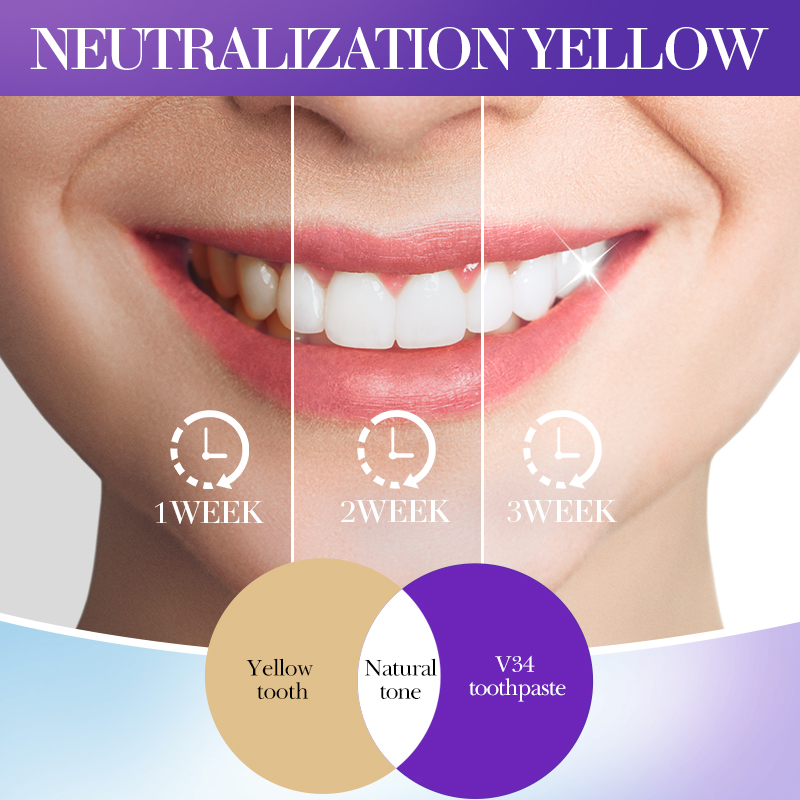 SADOER V34 Dentifricio Smacchi - Teeth Whitening Hismile recensione e prezzo