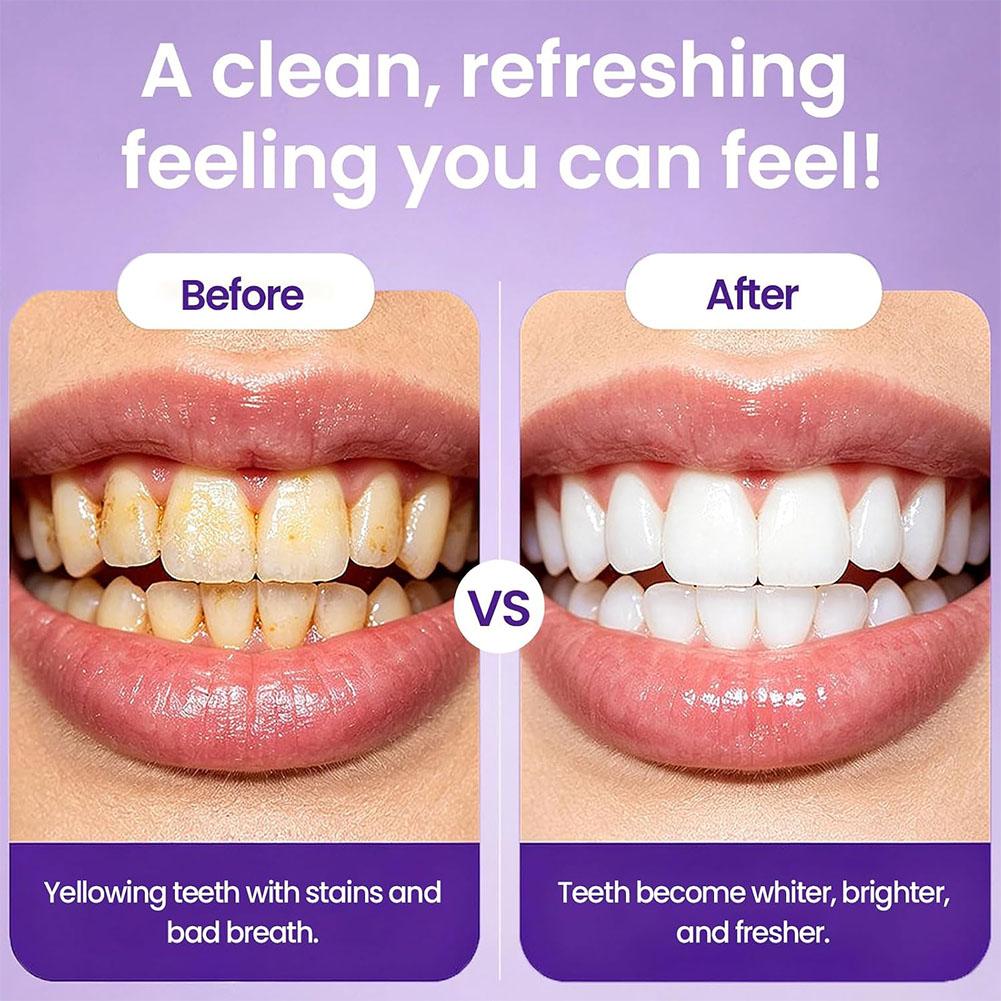 Compresse Sbiancanti per Denti - Teeth Whitening Yellow Teeth recensione e prezzo