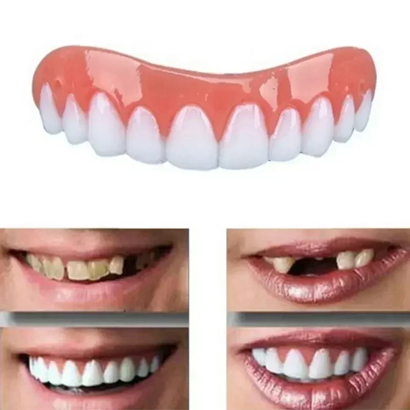 Nuove Faccette Dentali in Sili - Teeth Whitening Veneers recensione e prezzo