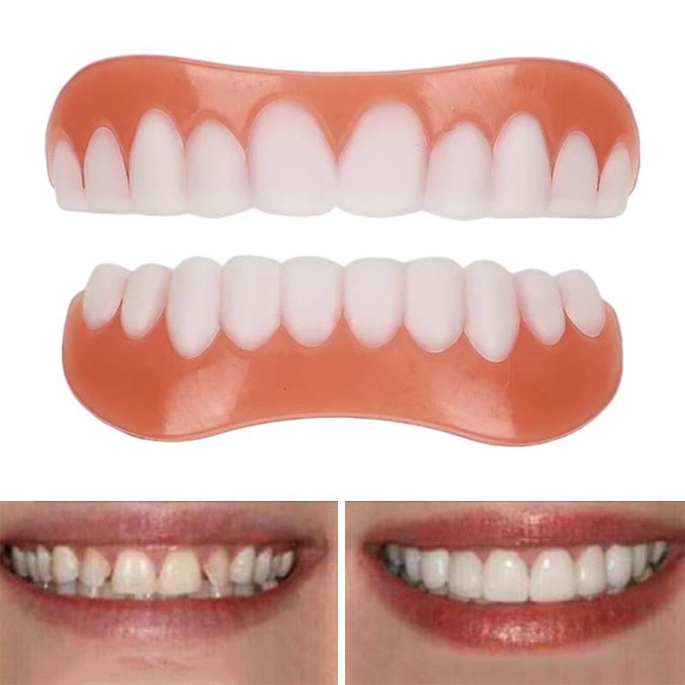 Nuove Faccette Dentali in Sili - Teeth Whitening Veneers recensione e prezzo