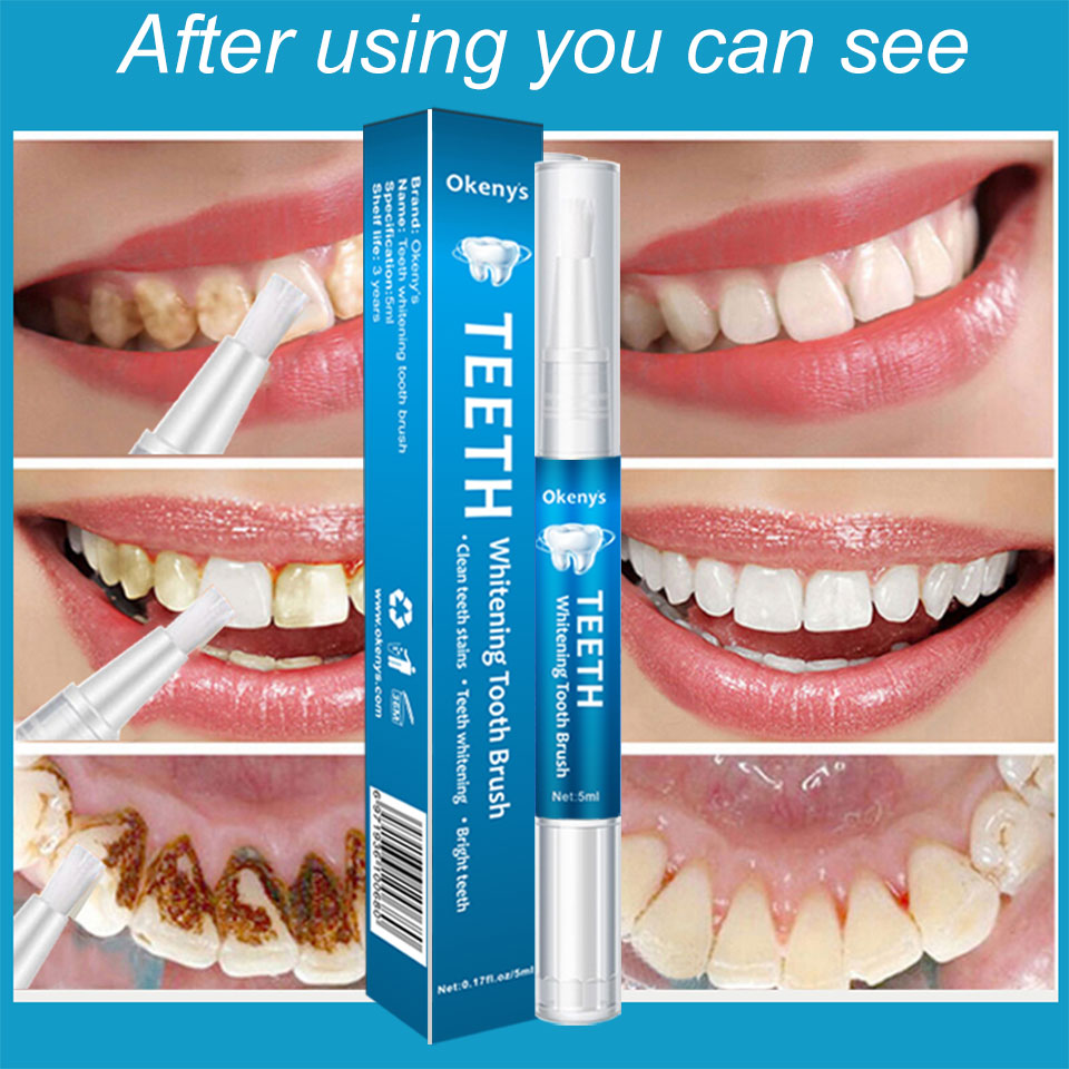 Kit sbiancante per denti da 5m - Teeth Whitening Xylitol recensione e prezzo