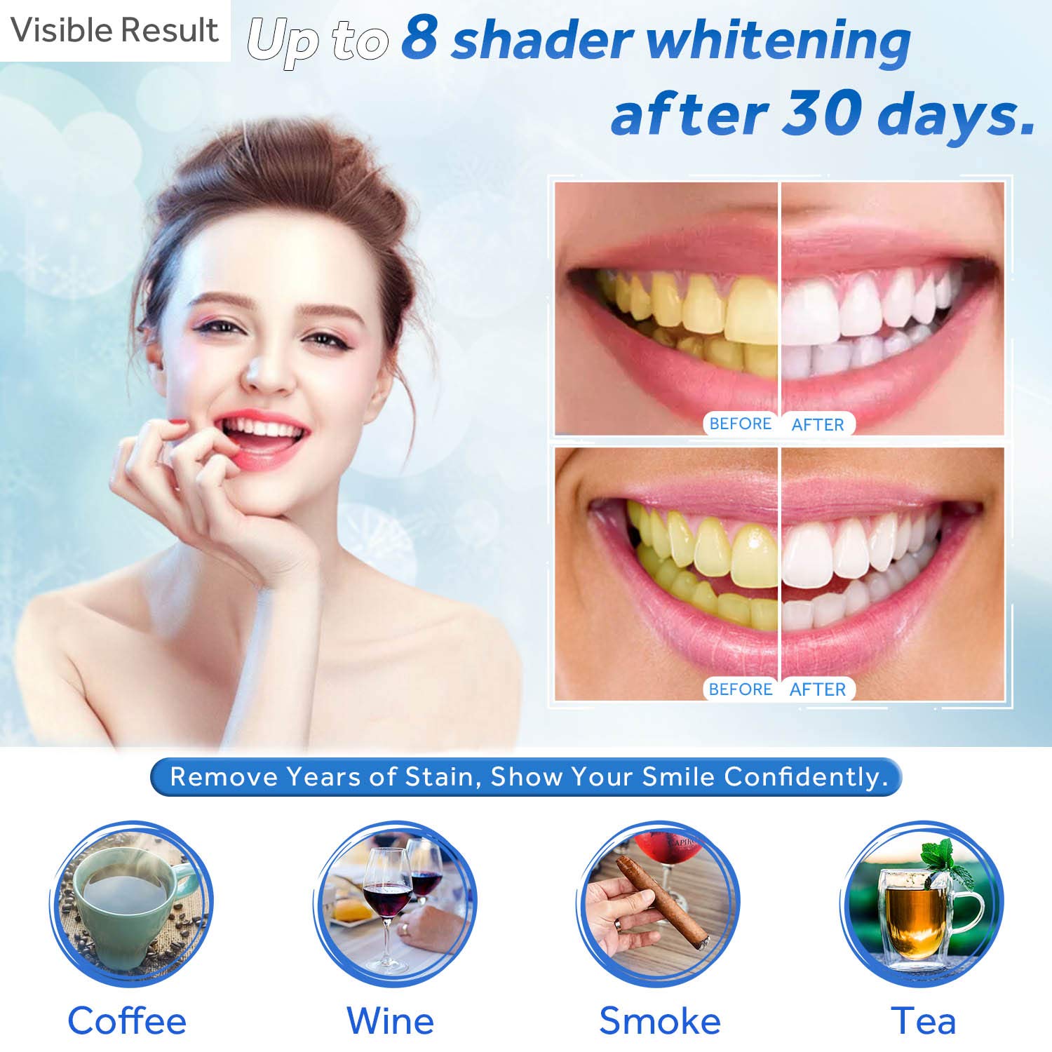 Gel sbiancante per denti Ricar - Teeth Whitening Gels recensione e prezzo