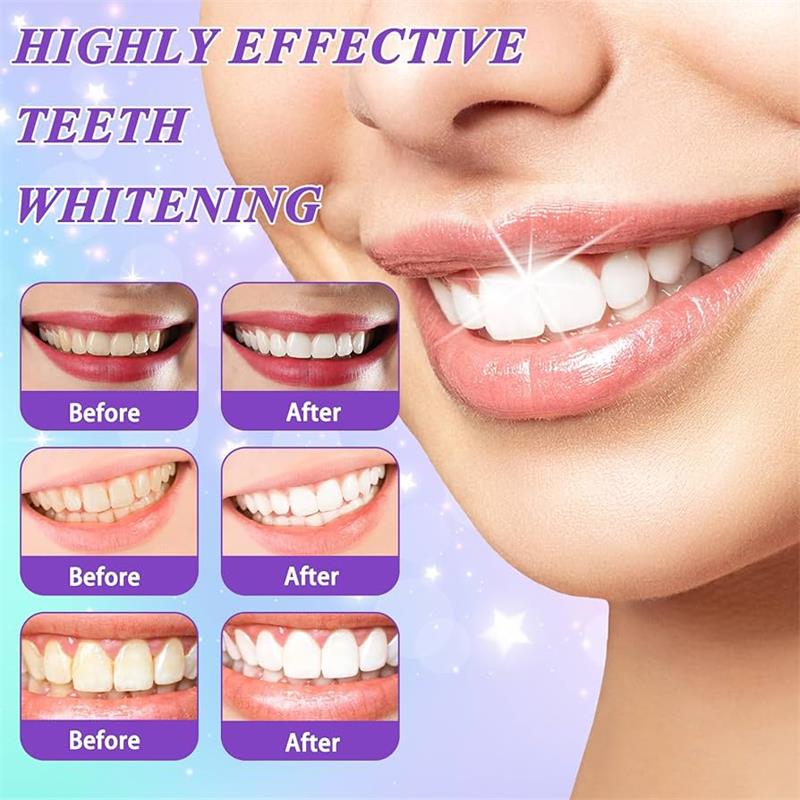 Dentifricio sbiancante 9D viol - Teeth Whitening Yellow Teeth recensione e prezzo