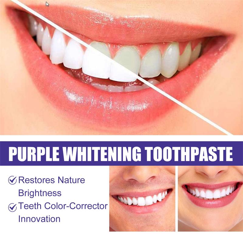 Dentifricio sbiancante 9D viol - Teeth Whitening Yellow Teeth recensione e prezzo