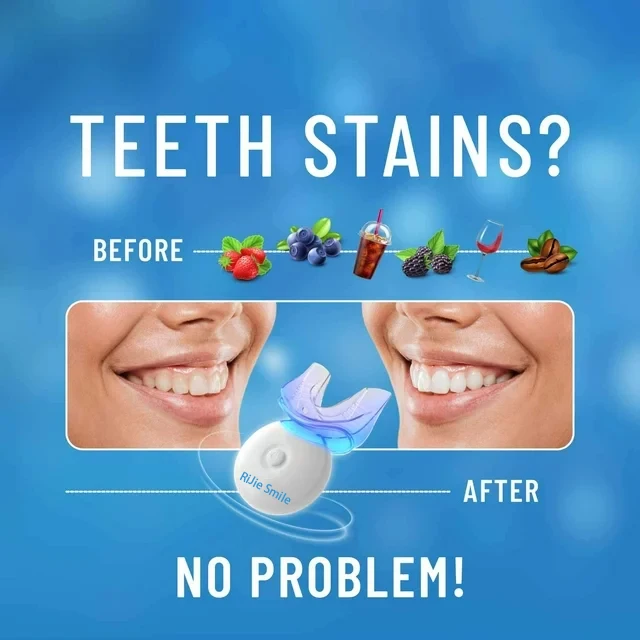 Kit di Pulizia di Alta Qualità - Teeth Whitening At Home Kit recensione e prezzo