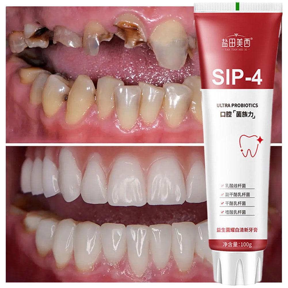 Dentifricio Sbiancante Probiot - Teeth Whitening Yellow Teeth recensione e prezzo