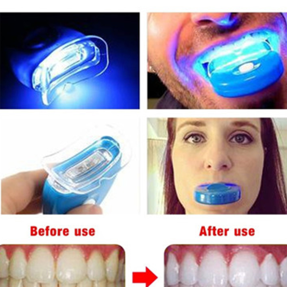 Nuovo Led blu sbiancamento dei - Teeth Whitening With Laser recensione e prezzo