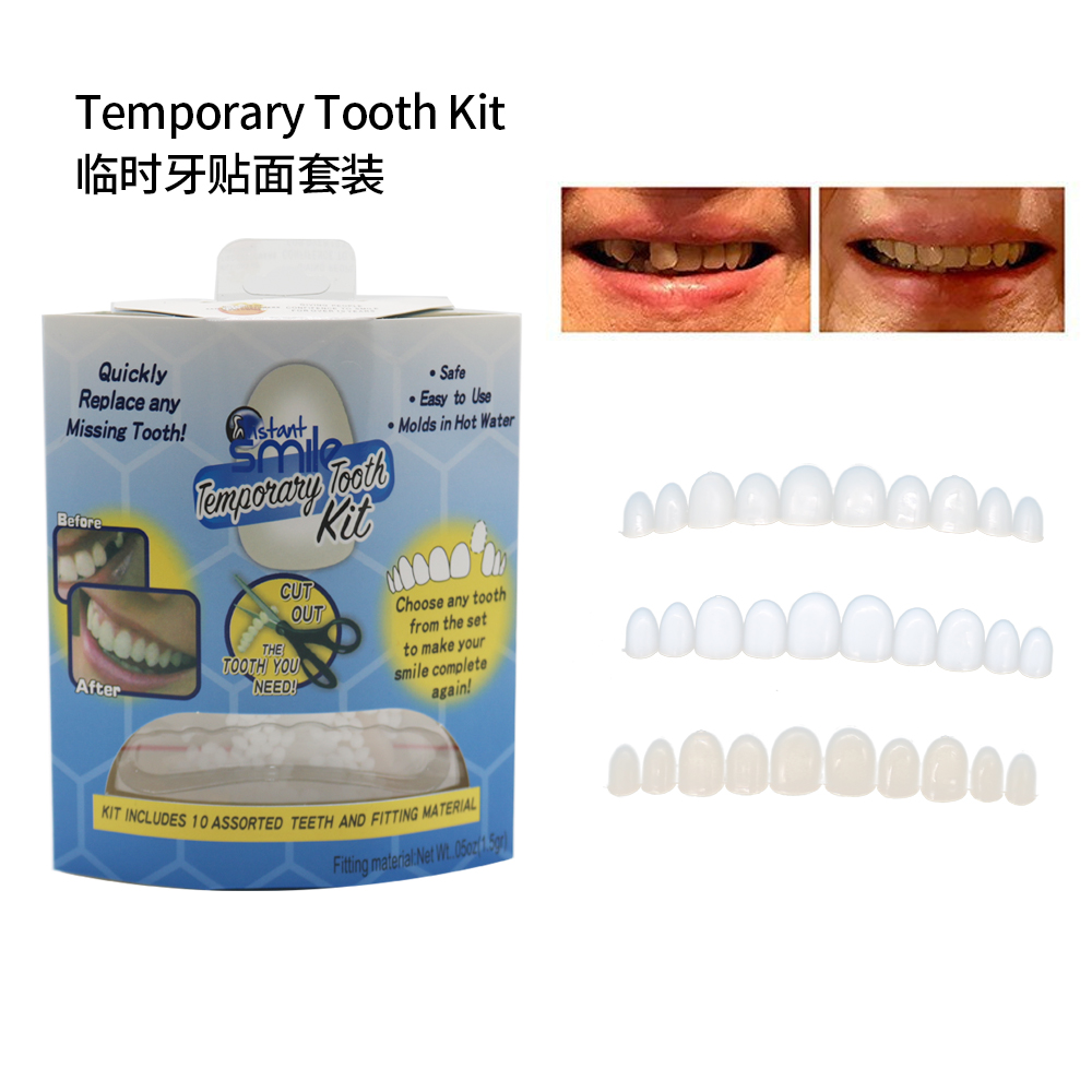 Denti finti Impiallacciature p - Teeth Whitening Veneers recensione e prezzo