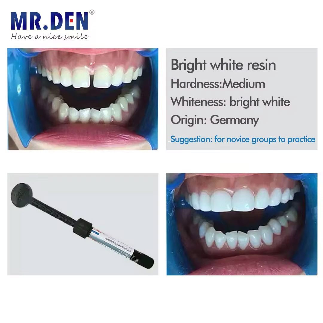 Materiale impiallacciato nano  - Teeth Whitening Veneers recensione e prezzo