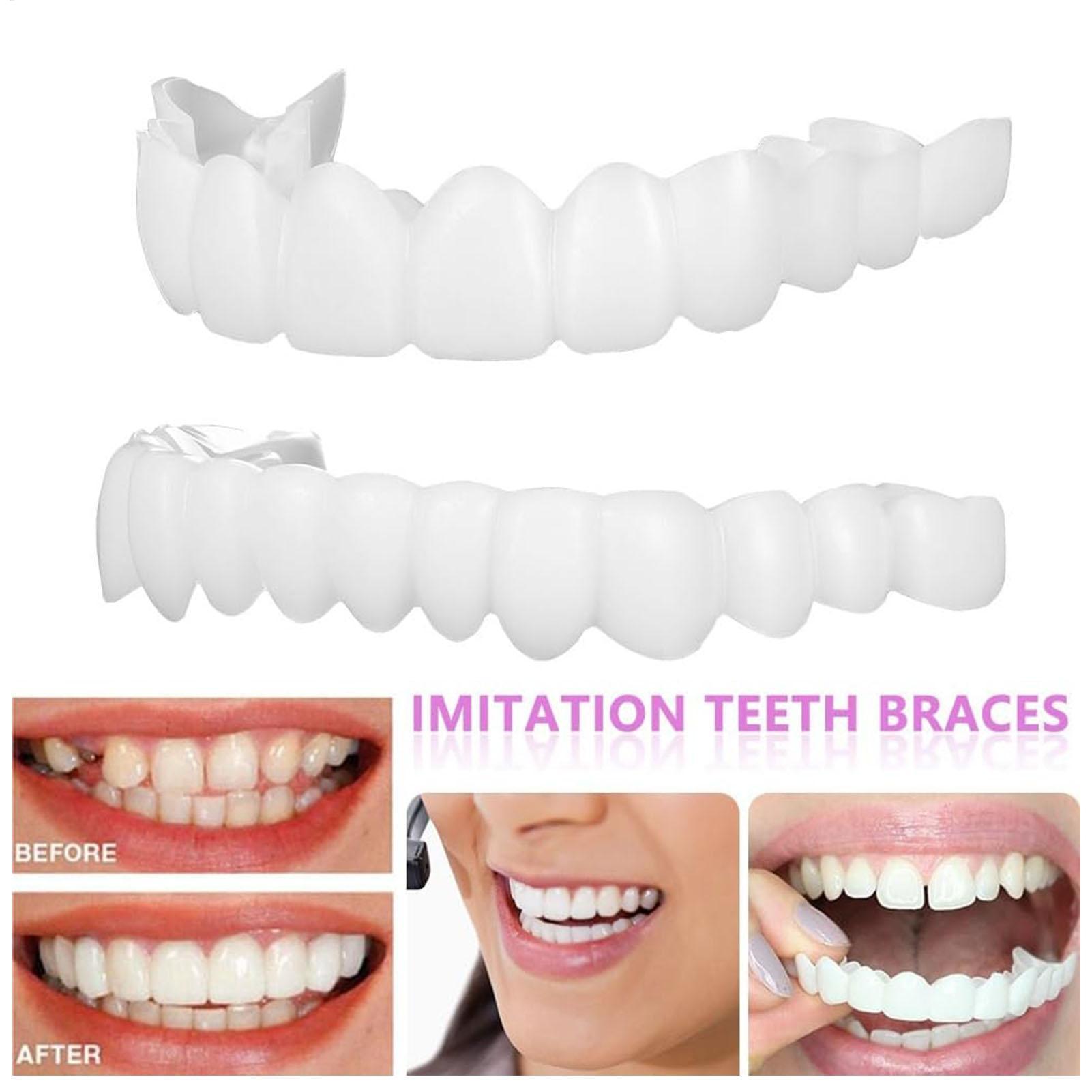 2 pz Uomo Donna Denti Temporan - Teeth Whitening Veneers recensione e prezzo