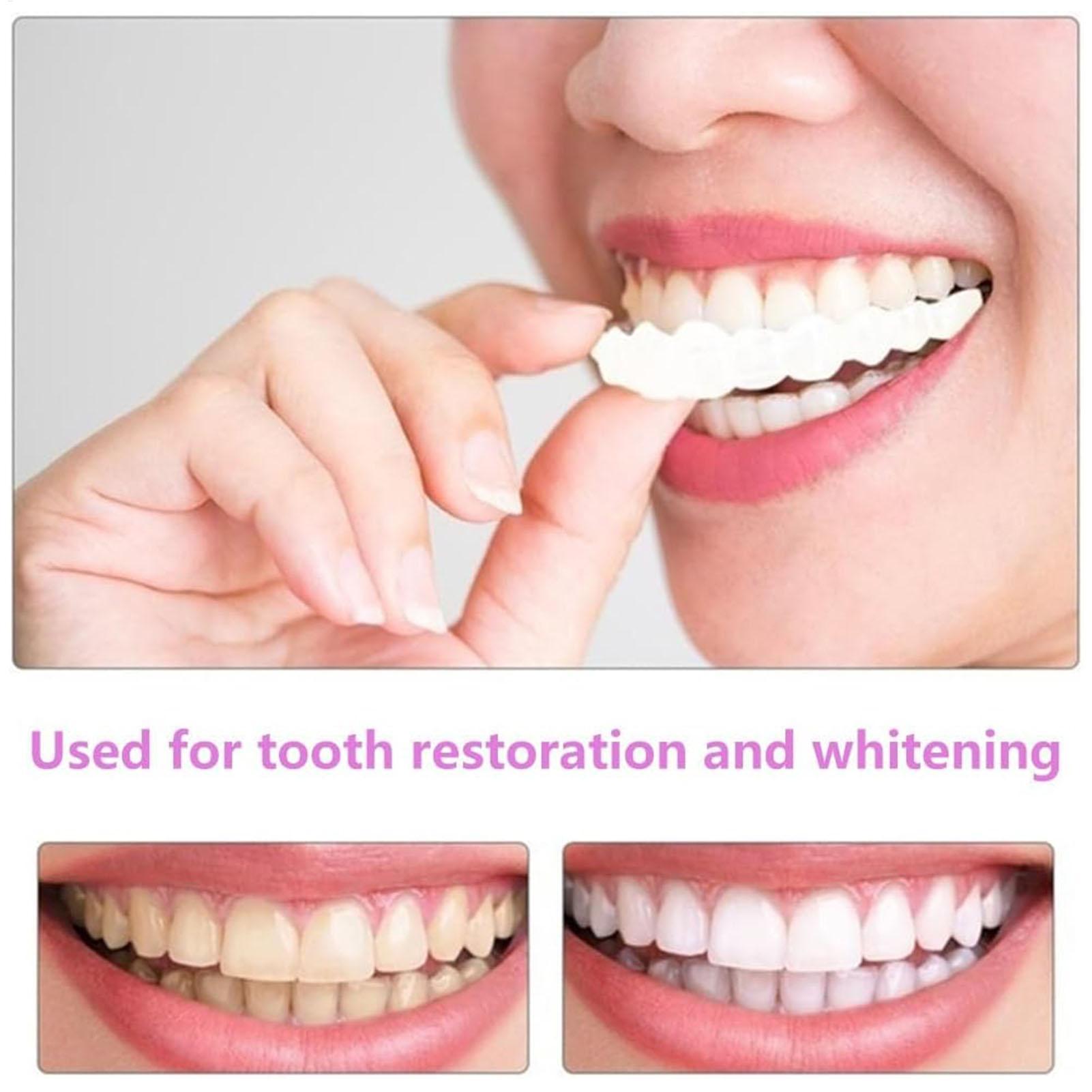 2 pz Uomo Donna Denti Temporan - Teeth Whitening Veneers recensione e prezzo