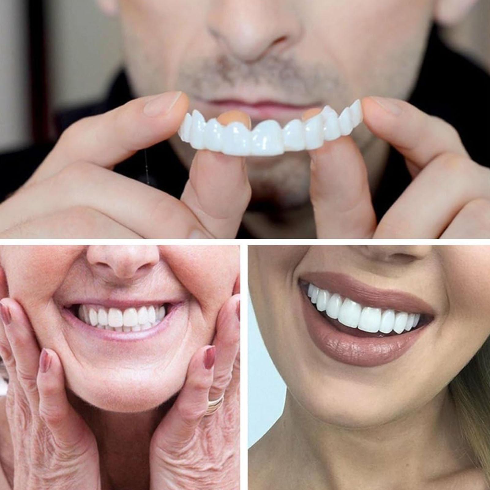 2 pz Uomo Donna Denti Temporan - Teeth Whitening Veneers recensione e prezzo